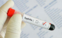 Экспресс анализ на сифилис
