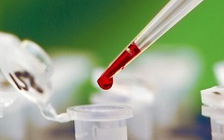 Исследование крови методом ПЦР